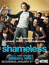 Shameless